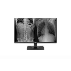 Moniteur 27" LG 4K vue 1